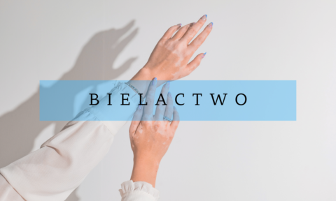 Bielactwo – nie takie rzadkie, jak je malują